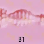 B1