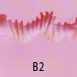 B2