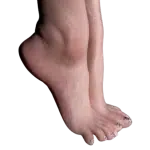 Standing feet without metal bolts