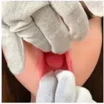 Fixed tongue