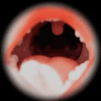 Robotic mouth (ROS needed)